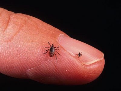 Tick Bite Prevention and Cure Tips for Preventing Ticks Bite